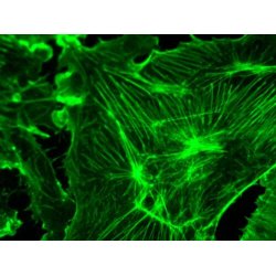 AmScope IN300 Trinokul�rt inverteret fasekontrast EPI-fluorescens mikroskop (40x�1000x)