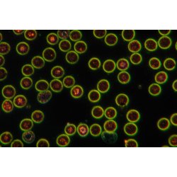 OMAX Advanced lysst�rk m�rkefeltkondensor til olieimmersion (NA 1,36-1,25) til biologiske mikroskoper